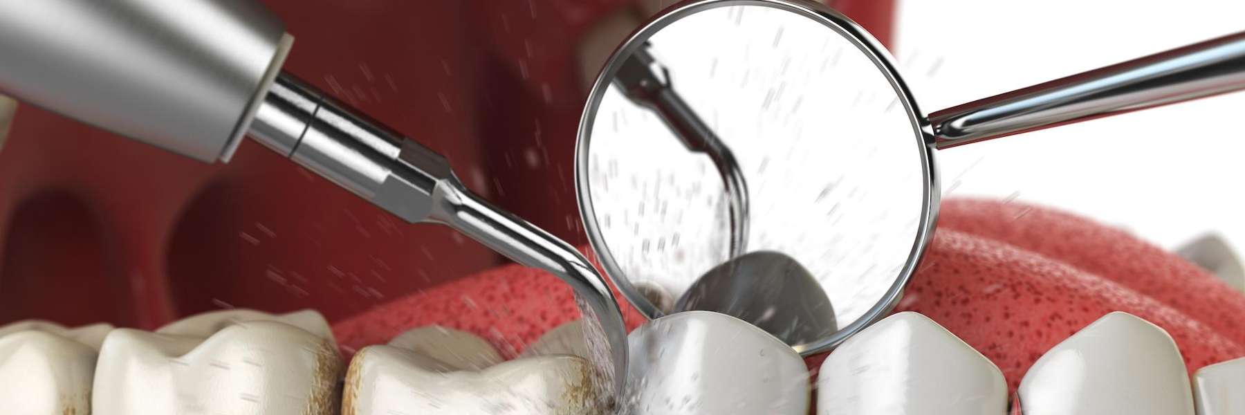 An illustration of a dental cleaning Services in Apex, NC