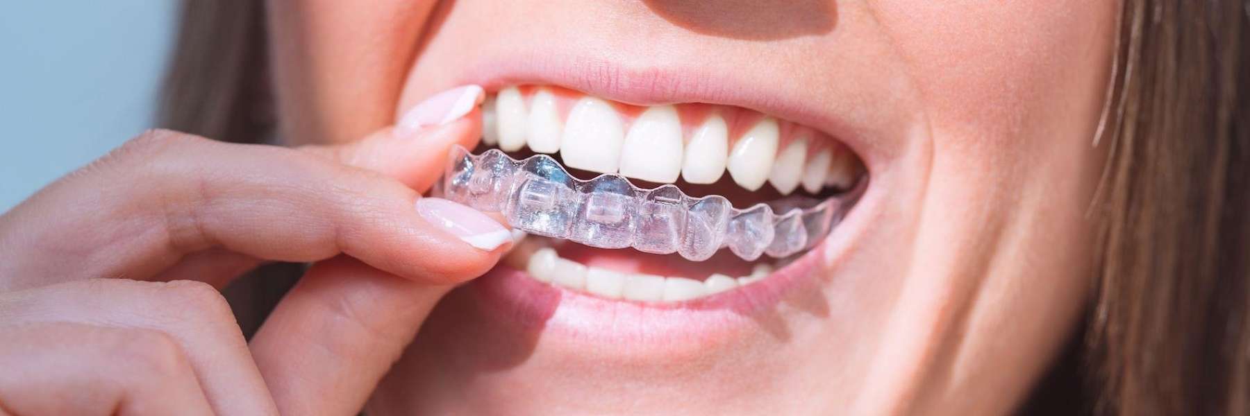 A woman wearing a clear aligner in Apex, NC