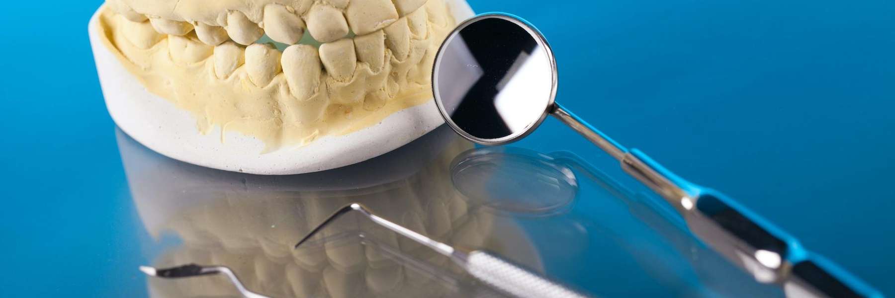 a dental cast in Apex, NC
