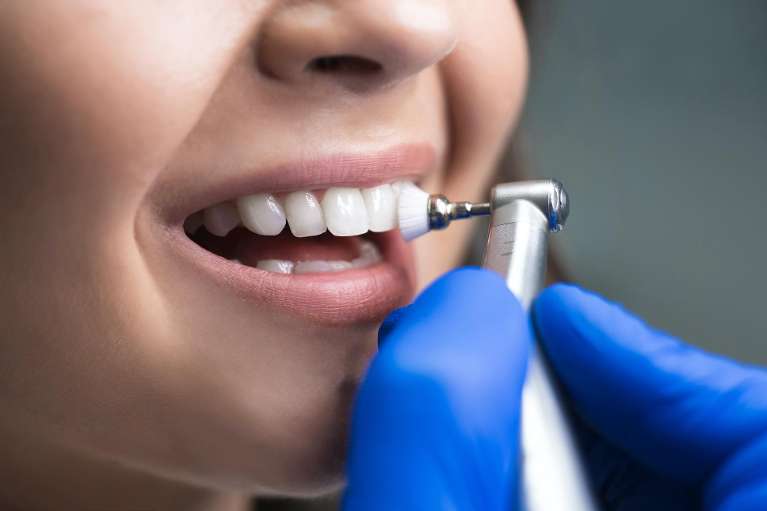 A patient getting her teeth Cleaned in Apex, NC