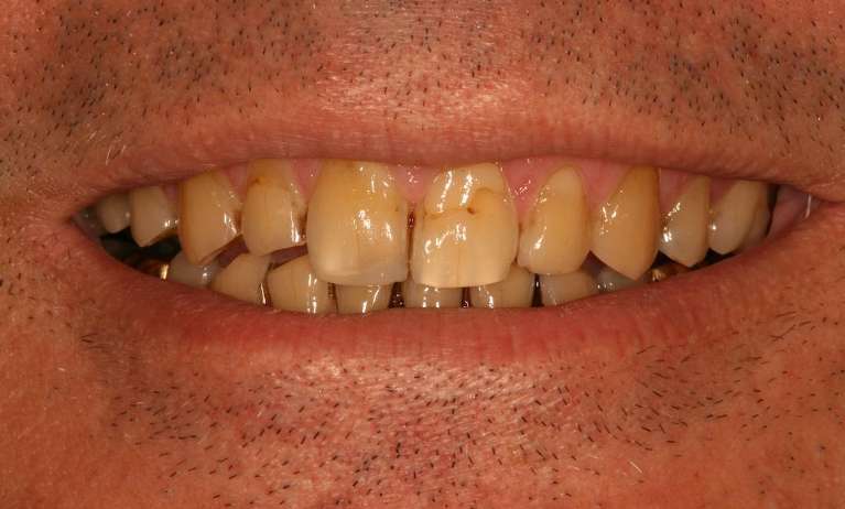 Cosmetic-Dentistry-Before-Image