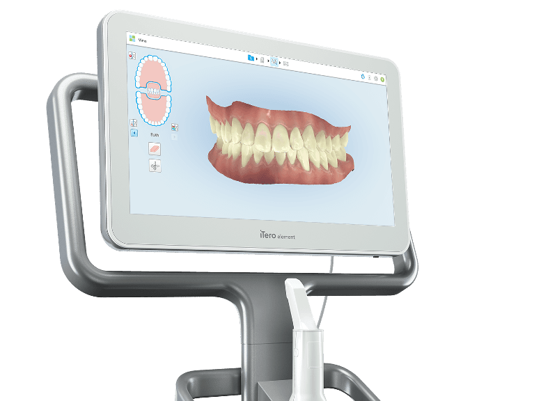Digital dental impressions displayed on a computer screen