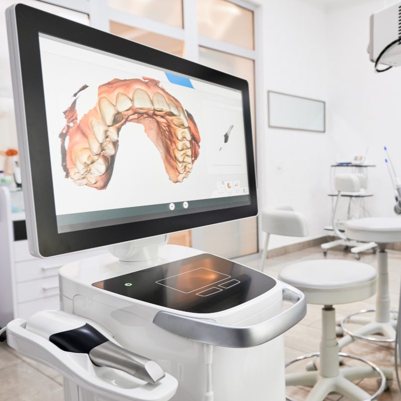 Digital dental scan displayed on a computer monitor